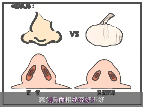 蒜头鼻面相终究好不好