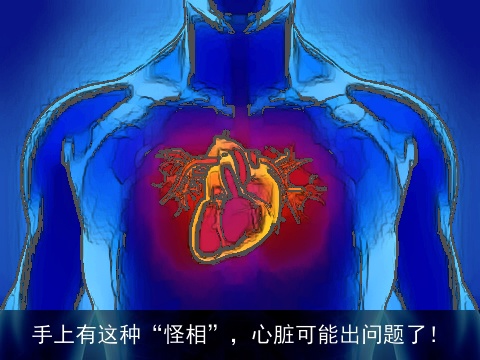手上有这种“怪相”，心脏可能出问题了！