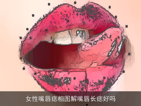 女性嘴唇痣相图解嘴唇长痣好吗