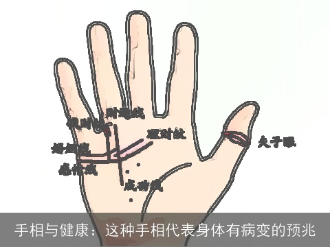 手相与健康：这种手相代表身体有病变的预兆