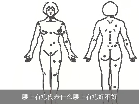 腰上有痣代表什么腰上有痣好不好