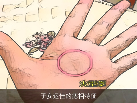 子女运佳的痣相特征