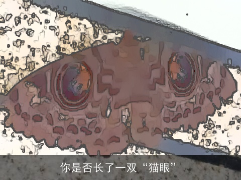 你是否长了一双“猫眼”