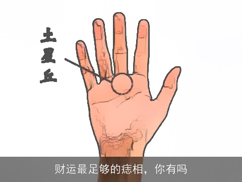 财运最足够的痣相，你有吗