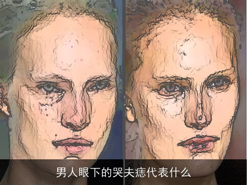 男人眼下的哭夫痣代表什么