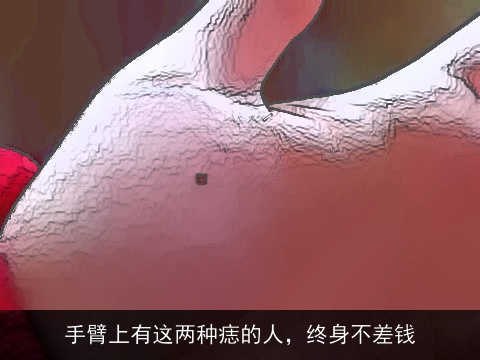手臂上有这两种痣的人，终身不差钱