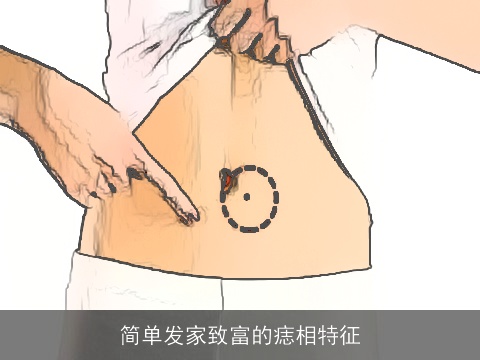 简单发家致富的痣相特征