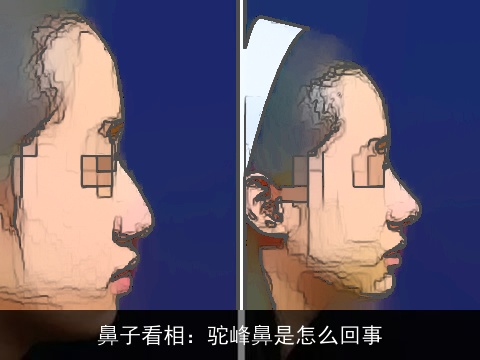 鼻子看相：驼峰鼻是怎么回事