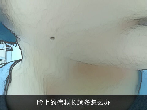 脸上的痣越长越多怎么办
