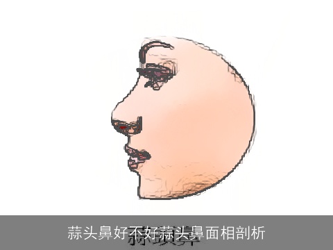 蒜头鼻好不好蒜头鼻面相剖析