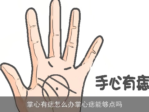 掌心有痣怎么办掌心痣能够点吗