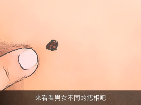 来看看男女不同的痣相吧