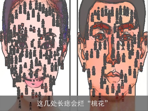 这几处长痣会烂“桃花”