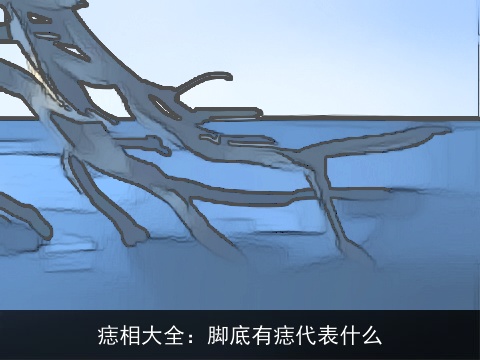 痣相大全：脚底有痣代表什么