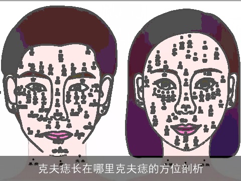 克夫痣长在哪里克夫痣的方位剖析
