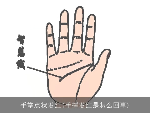 手掌点状发红(手撑发红是怎么回事)