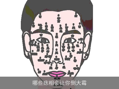 哪些痣相会让你倒大霉