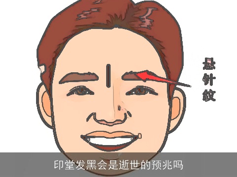 印堂发黑会是逝世的预兆吗