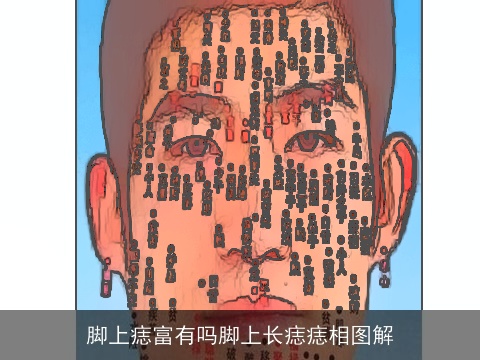 脚上痣富有吗脚上长痣痣相图解