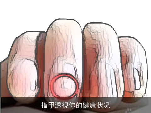 指甲透视你的健康状况