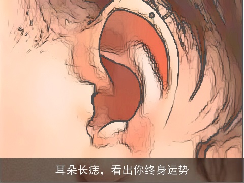 耳朵长痣，看出你终身运势