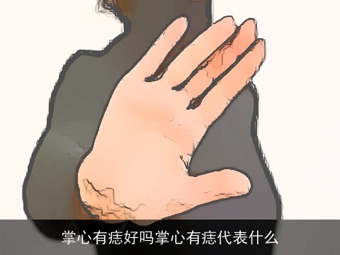 掌心有痣好吗掌心有痣代表什么