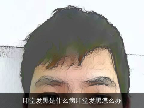 印堂发黑是什么病印堂发黑怎么办