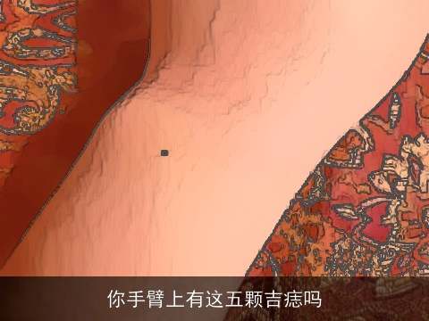 你手臂上有这五颗吉痣吗