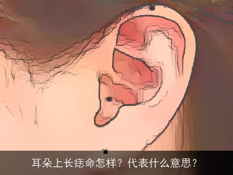 耳朵上长痣命怎样？代表什么意思？