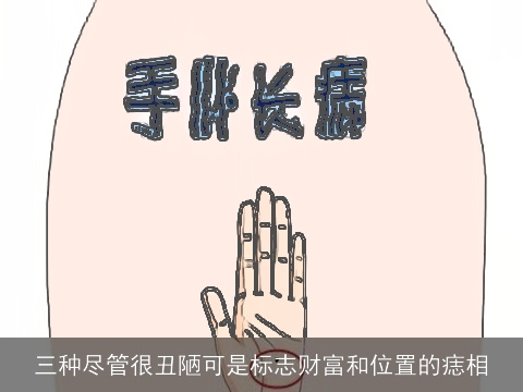 三种尽管很丑陋可是标志财富和位置的痣相