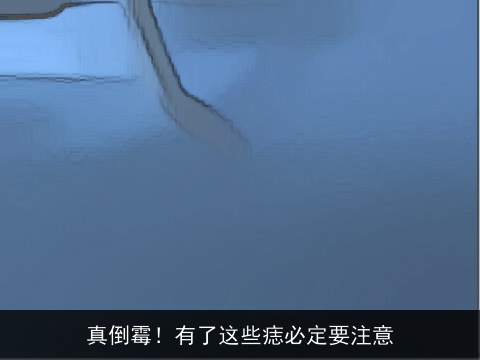 真倒霉！有了这些痣必定要注意