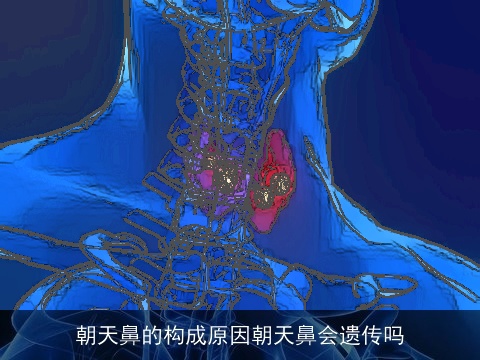 朝天鼻的构成原因朝天鼻会遗传吗