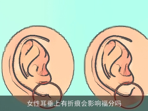 女性耳垂上有折痕会影响福分吗