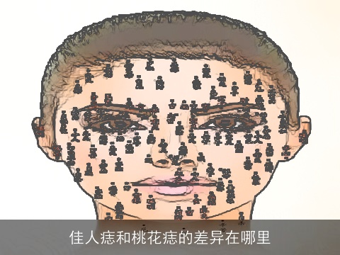 佳人痣和桃花痣的差异在哪里