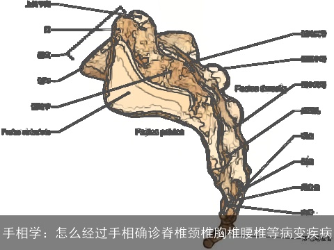 手相学：怎么经过手相确诊脊椎颈椎胸椎腰椎等病变疾病