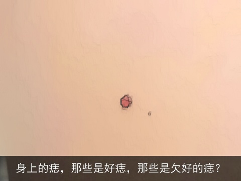 身上的痣，那些是好痣，那些是欠好的痣？