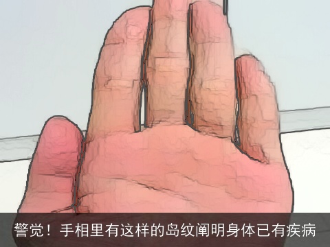 警觉！手相里有这样的岛纹阐明身体已有疾病