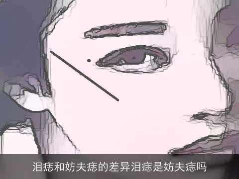 泪痣和妨夫痣的差异泪痣是妨夫痣吗