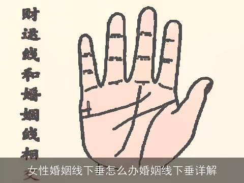 女性婚姻线下垂怎么办婚姻线下垂详解