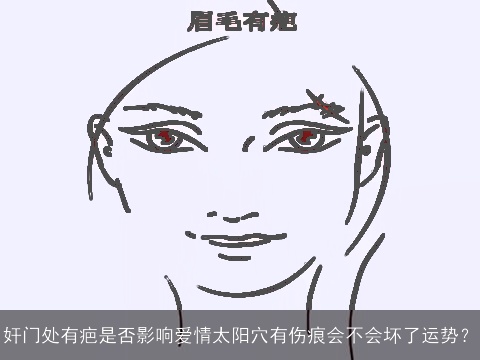 奸门处有疤是否影响爱情太阳穴有伤痕会不会坏了运势？