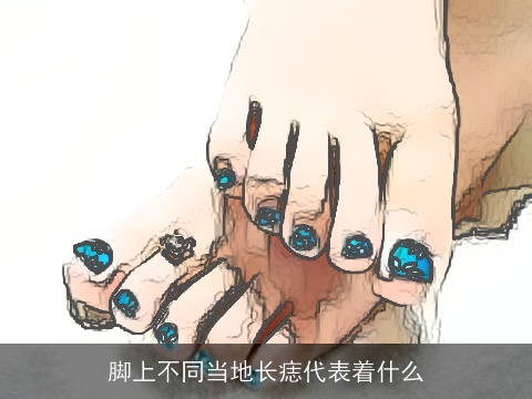 脚上不同当地长痣代表着什么