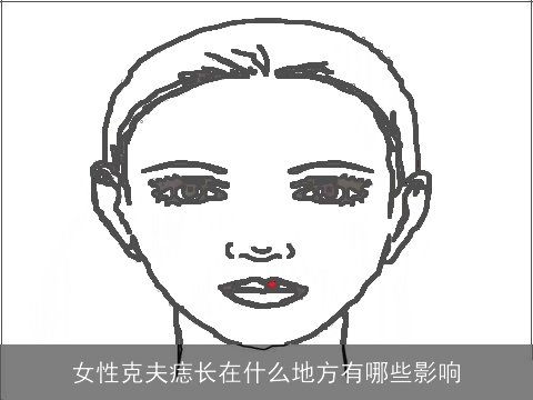 女性克夫痣长在什么地方有哪些影响