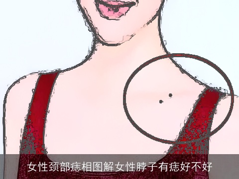 女性颈部痣相图解女性脖子有痣好不好