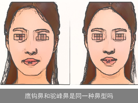 鹰钩鼻和驼峰鼻是同一种鼻型吗
