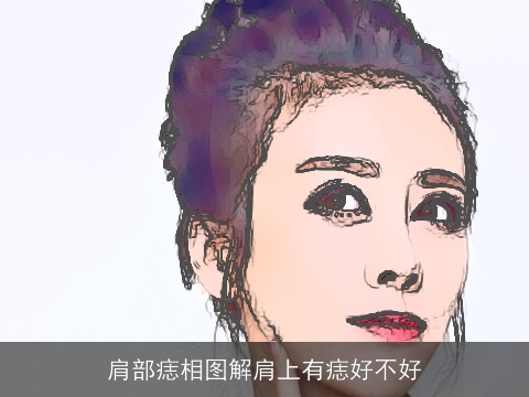 肩部痣相图解肩上有痣好不好