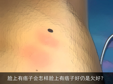 脸上有痦子会怎样脸上有痦子好仍是欠好？