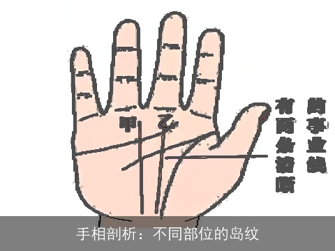 手相剖析：不同部位的岛纹