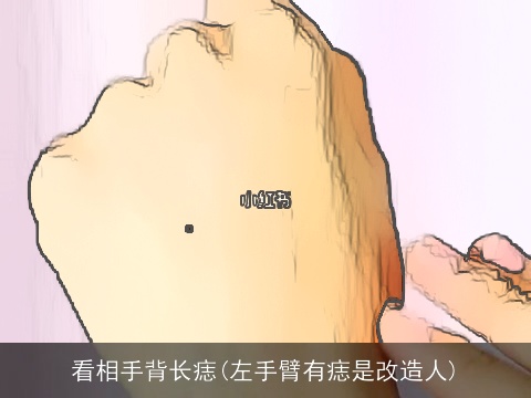 看相手背长痣(左手臂有痣是改造人)